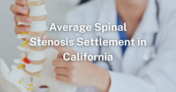 Average Spinal Stenosis Workers’ Comp Settlement in California
