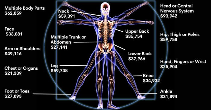 workers' comp settlement body part prices