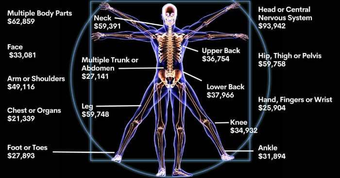 california-workers-comp-settlement-chart-by-injury-type-cause-2023